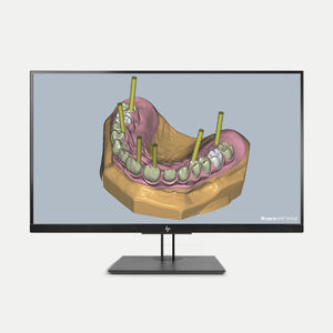 modulo software per implantologia dentale