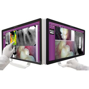 monitor per odontoiatria