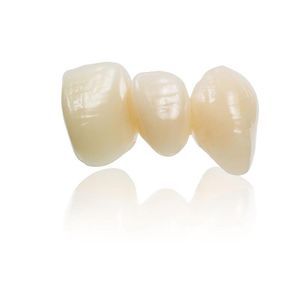 materiale odontoiatrico in ceramica di vetro 1