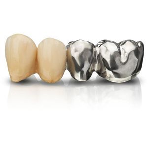 materiale odontoiatrico in cobalto-cromo 1
