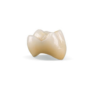 materiale odontoiatrico in ceramica di vetro