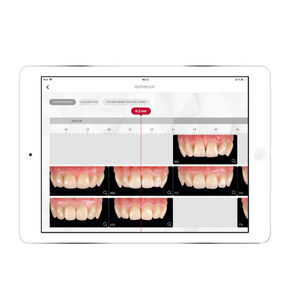 applicazione iOS odontoiatrica