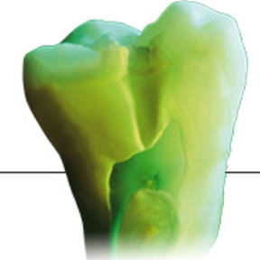 materiale odontoiatrico in ceramica