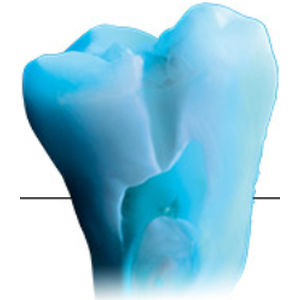 materiale odontoiatrico in ceramica