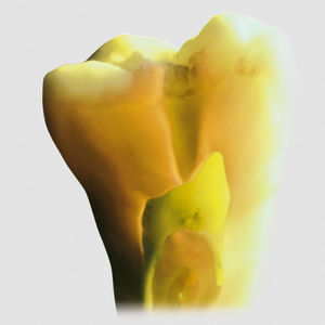 materiale odontoiatrico in ceramica