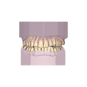 modulo software ortodontico