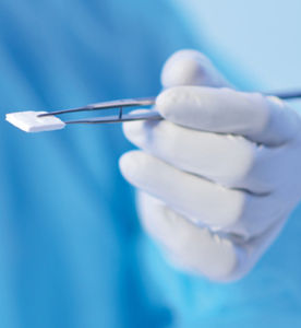 matrice tissutale chirurgia odontoiatrica 1