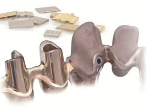 materiale odontoiatrico in lega