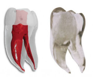 modello anatomico di denti