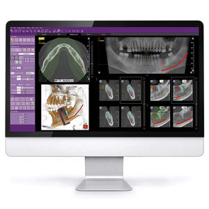 software per imaging odontoiatrico