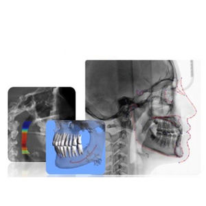 software per imaging odontoiatrico