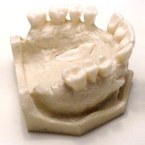 modello anatomico di dentatura / ad uso didattico / per chirurgia