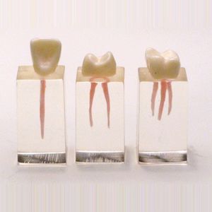 modello anatomico di denti