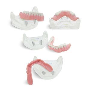 modello anatomico di dentatura