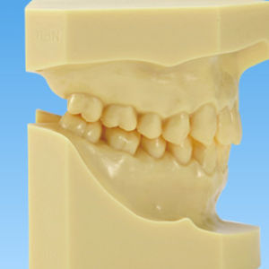 modello anatomico di dentatura