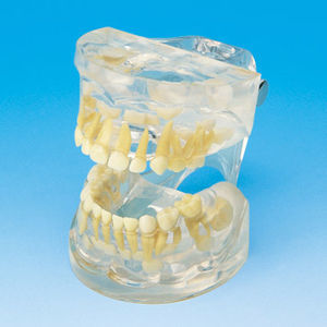 modello anatomico di dentatura
