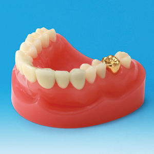 modello anatomico di dentatura
