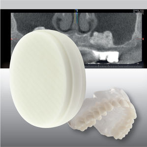 materiale odontoiatrico in PMMA / CAD CAM / per imaging odontoiatrico / di fresatura