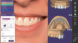 software per implantologia dentale