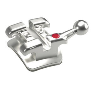 bracket ortodontici in metallo 1