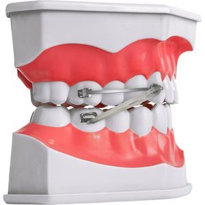 bracket ortodontici in metallo