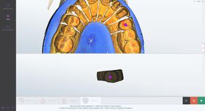 software per laboratorio dentale