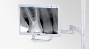 monitor per odontoiatria