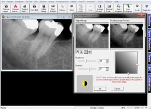 software per imaging odontoiatrico