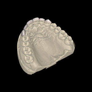 modulo software per laboratorio dentale