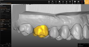 modulo software per laboratorio dentale