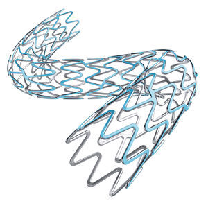stent coronarico