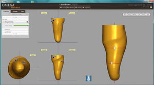 software ortopedico