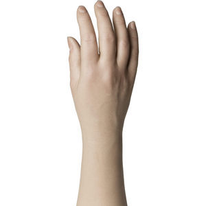 protesi estetica mano