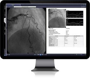 PACS per diagnostica per immagini