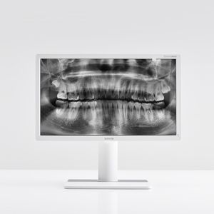 monitor diagnostico