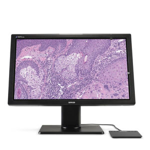 monitor diagnostico