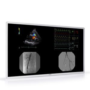 monitor per radiologia