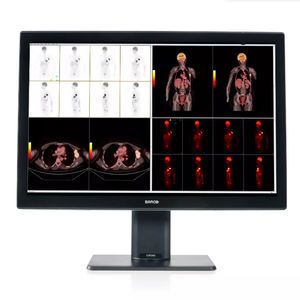 monitor medico