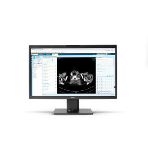 monitor 32