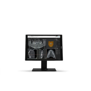 monitor diagnostico