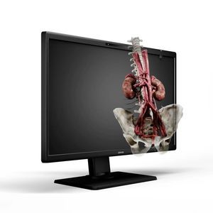 monitor medico