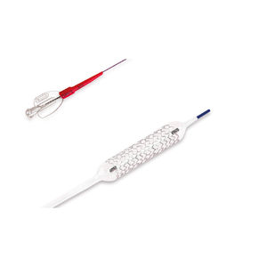 stent coronarico 1