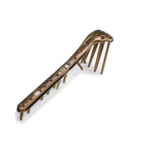 placca di compressione per tibia