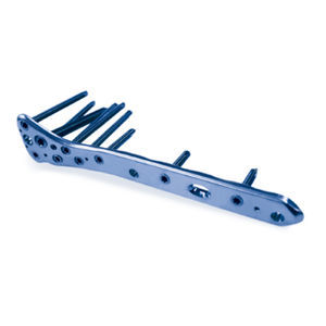 placca di compressione per femore