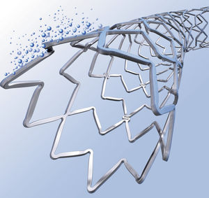 stent coronarico 1