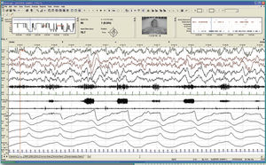 software per EEG