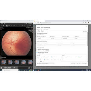 software per oftalmologia