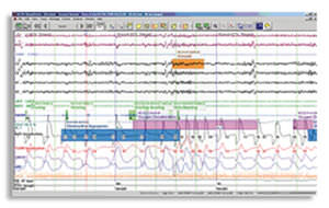 software per polisonnografia