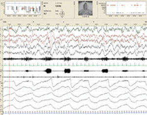 software di gestione / di analisi / diagnostico / di acquisizione