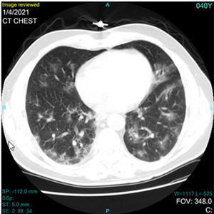 software di diagnosi del Covid-19